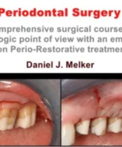 Periodontal Surgery: A Comprehensive Surgical Course (Course)