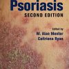 Psoriasis, Second Edition (EPUB)