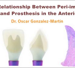 The Relationship Between Peri-implant Tissue and Prosthesis in the Anterior Area (Course)