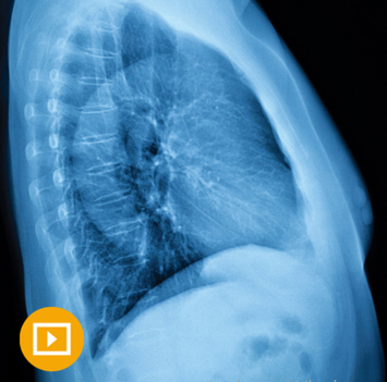 UCSF Thoracic Imaging 2023 (Course)