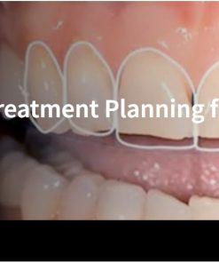 Esthetic and Functional Treatment Planning for Wear Patients