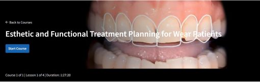 Esthetic and Functional Treatment Planning for Wear Patients