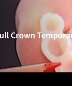 Classic Collection: Anterior Full Crown Temporaries