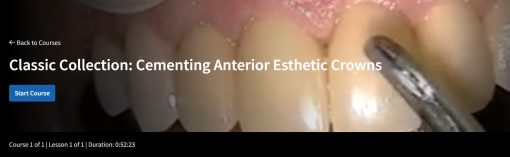 Classic Collection: Cementing Anterior Esthetic Crowns