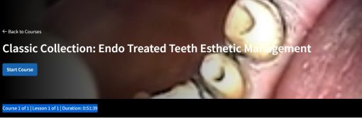 Classic Collection: Endo Treated Teeth Esthetic Management