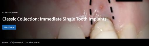 Classic Collection: Immediate Single Tooth Implants