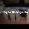 Using Positioners for Direct Digital Radiography