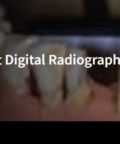 Using Positioners for Direct Digital Radiography