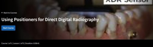 Using Positioners for Direct Digital Radiography