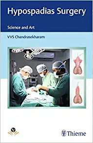 Hypospadias Surgery: Science and Art (PDF Book)