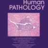 Human Pathology PDF