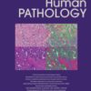 Human Pathology PDF