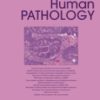 Human Pathology PDF