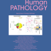 Human Pathology PDF