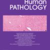 Human Pathology Volume 138