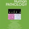 Human Pathology Volume 139