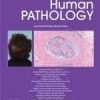 Human Pathology Volume 140