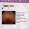 Journal Of American Association For Pediatric Ophthalmology And Strabismus Volume 27, Issue 6