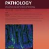 The American Journal of Pathology PDF