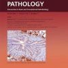 The American Journal of Pathology PDF