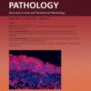 The American Journal of Pathology PDF