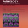 The American Journal of Pathology PDF