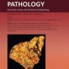 The American Journal of Pathology PDF