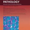 The American Journal Of Pathology Volume 193, Issue 10