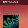 The American Journal of Pathology PDF