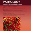 The American Journal of Pathology PDF