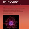 The American Journal of Pathology PDF