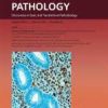 The American Journal Of Pathology Volume 193, Issue 8