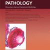 The American Journal Of Pathology Volume 193, Issue 9