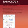 The American Journal of Pathology PDF