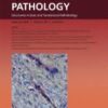 The American Journal of Pathology PDF