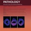 The American Journal of Pathology PDF