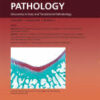 The American Journal of Pathology PDF