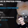 Corso Base di Protesi Fissa su Impianti, Il Dente Singolo Posteriore (Course)