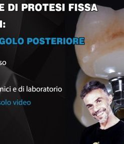 Corso Base di Protesi Fissa su Impianti, Il Dente Singolo Posteriore (Course)