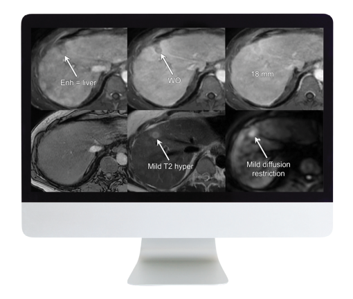 Liver, Pancreatic, and Biliary Tumors: Practical Tips to Improve Your Clinical Practice (Course)