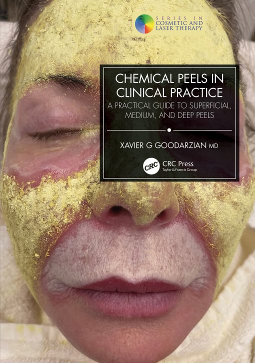 Chemical Peels in Clinical Practice (PDF)