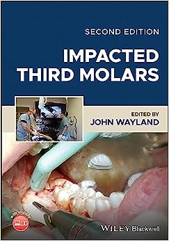 Impacted Third Molars, 2nd Edition (PDF Book)