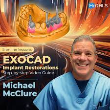 OHI-S EXOCAD Implant Restorations – Step-by-step Video Guide 2023 (Course)