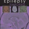 Epilepsy Simplified (ePub Book)