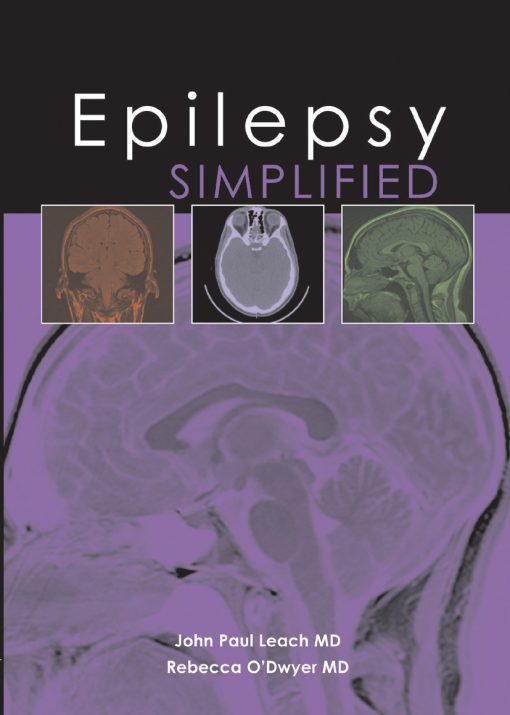 Epilepsy Simplified (ePub Book)