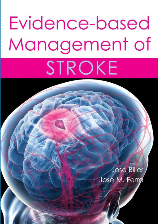 Evidence-based Management of Stroke (ePub Book)