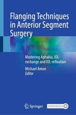 Flanging Techniques in Anterior Segment Surgery (PDF Book)