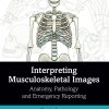 Interpreting Musculoskeletal Images (ePub Book)