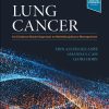 Lung Cancer: An Evidence-Based Approach to Multidisciplinary Management (ePub Book)