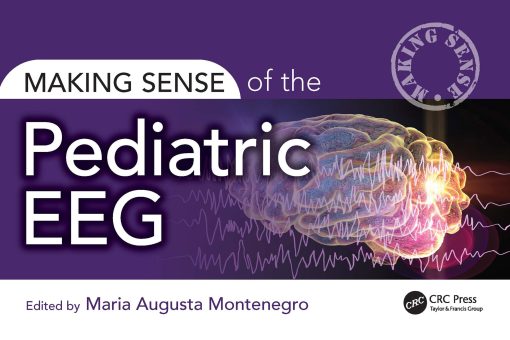 Making Sense of the Pediatric EEG (ePub Book)